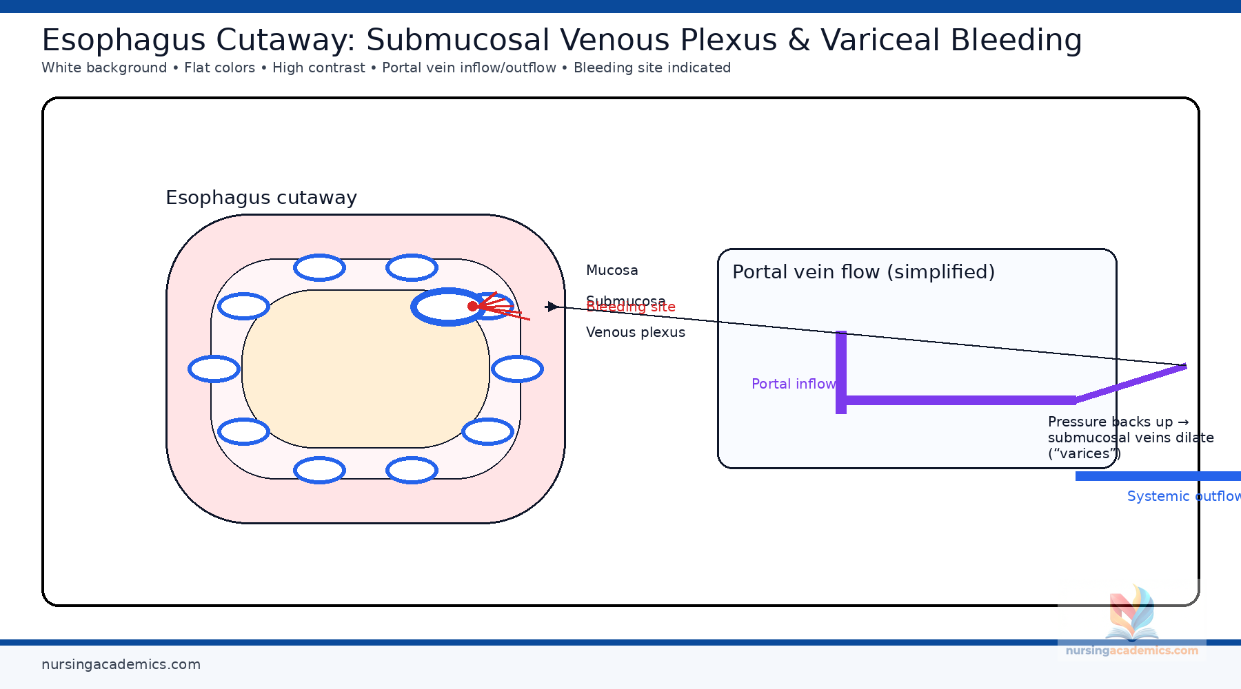 Esophageal varices visual