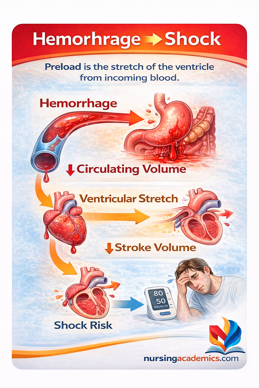 Stroke & Cerebrovascular Accident (CVA) - Adaptive LPN NCLEX Tutorial preview
